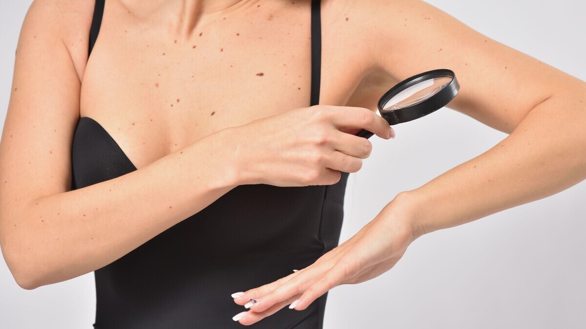 Заметили это на теле? Срочно бегите к врачу, а то будет поздно