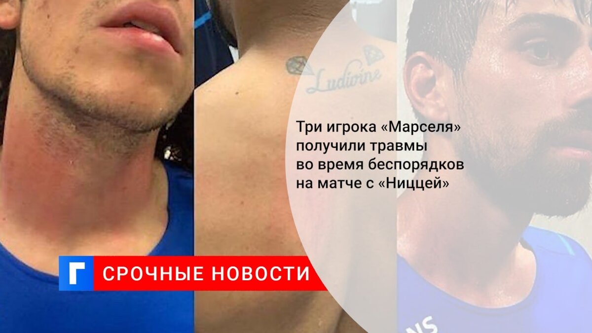 Три игрока «Марселя» получили травмы во время беспорядков на матче с «Ниццей»