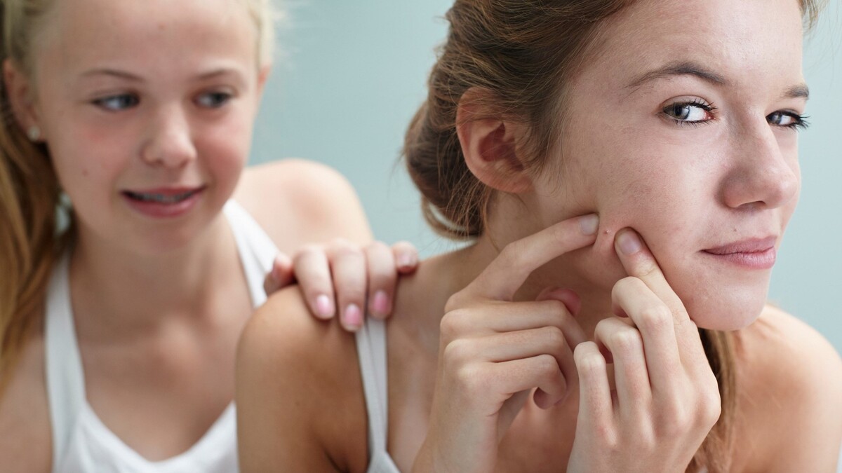 Вредные советы для вашей кожи: эти способы точно не помогут в борьбе с акне
