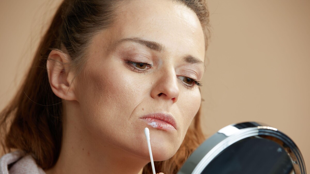 Никогда не делайте это, если выскочил герпес: вот какой ужас может случиться