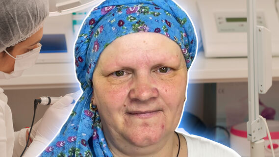 Преображение женщины с алопецией
