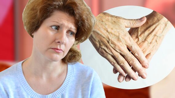 Как избавиться от надоевших пигментных пятен