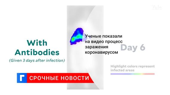 Ученые показали на видео процесс заражения коронавирусом 