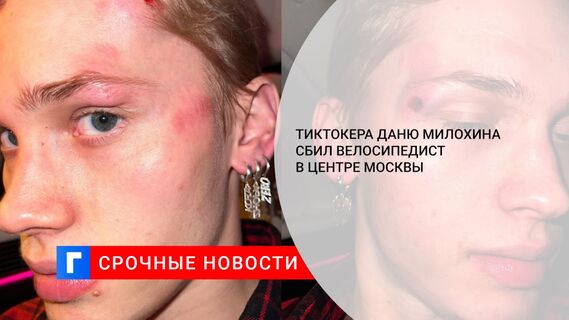 Тиктокера Даню Милохина сбил велосипедист в центре Москвы