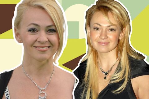 Последствия могли стать роковыми: Рудковской пришлось отказаться от большой груди