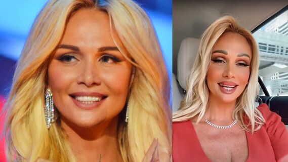 Забыла про фильтры: 38-летняя Лопырева засветила проблемное декольте