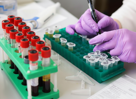 Ученые приручили морских микроскопических «монстров»: тест на рак за секунды