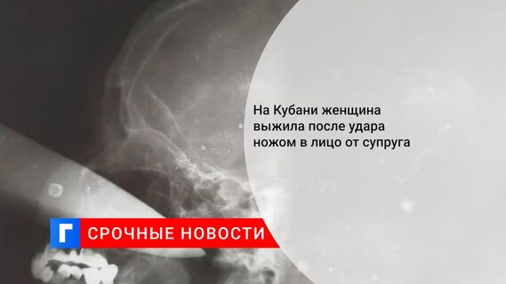 На Кубани женщина выжила после удара ножом в лицо от супруга