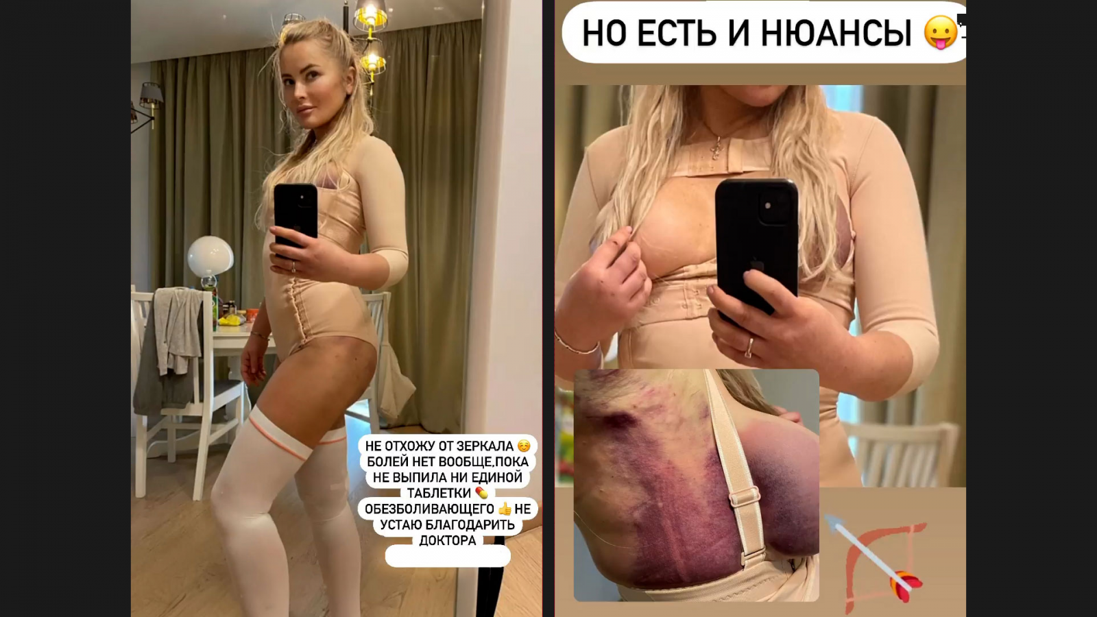 «Не отхожу от зеркала»: Борисова похвасталась уникальной пластической операцией - image 1